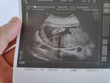21 week scan (7 January 2020): Foot